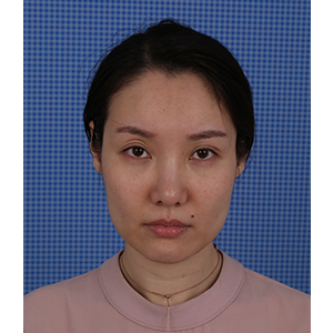 美萊案例于美眉對比圖后