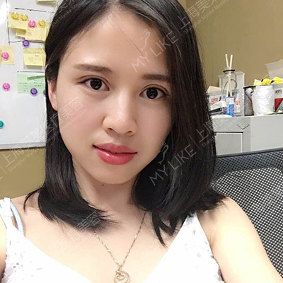 術(shù)后半個月