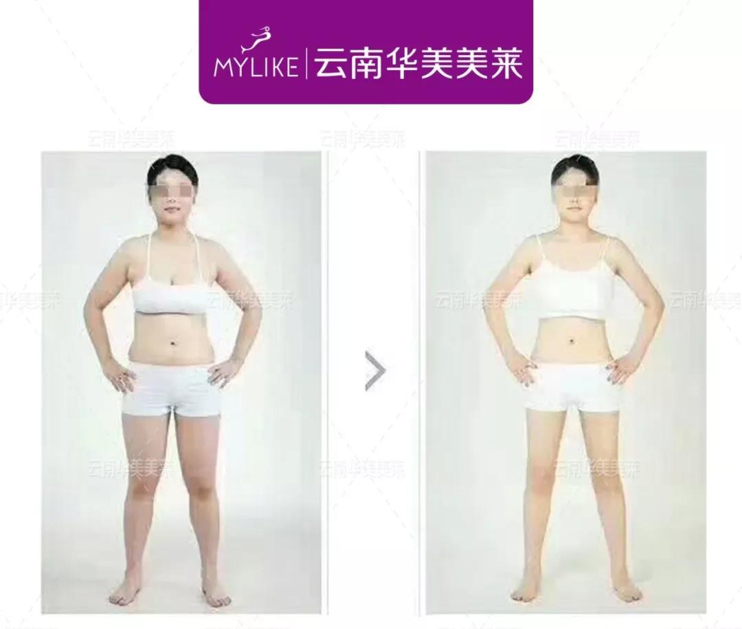 <a href='/xzjf/' target='_blank'><u>吸脂減肥</u></a>是優(yōu)勢(shì)有哪些