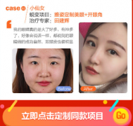 石家莊美萊割埋線(xiàn)割雙眼皮安全不安全