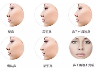 鼻子打玻尿酸后會(huì)變寬嗎