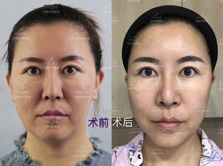 不為取悅，只為自己 美萊被授予“美國(guó)QUILL快翎線?授權(quán)認(rèn)證機(jī)構(gòu)”