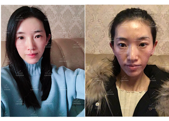 2011年環(huán)球游艇模特大賽十佳及單項獎小姐姐必做的醫(yī)美項目?。∶廊R雙十一get好物推薦