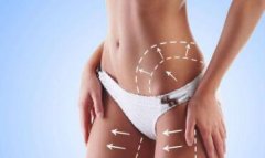 福州埋線(xiàn)減肥效果好不好