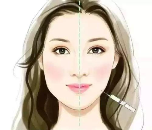 西安瘦臉多少錢(qián)