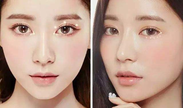 天津美萊做雙眼皮好不好？