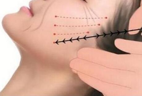 北京全臉埋線提升大約需多少錢(qián)