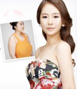 廣州做自體脂肪隆胸多少錢？