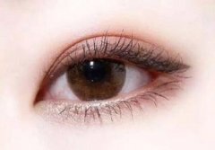 上海做雙眼皮價(jià)格一般是多少？