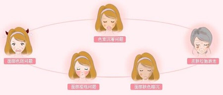 黑臉娃娃祛斑是什么