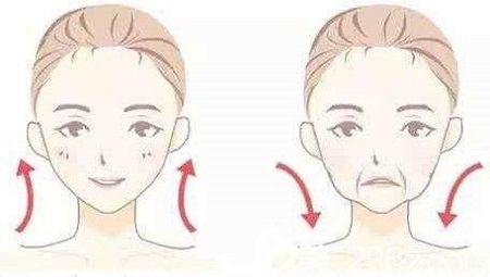 脂肪填充法令紋能維持多少時間？