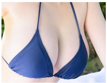 杭州做自體脂肪隆胸術(shù)創(chuàng)傷大嗎？