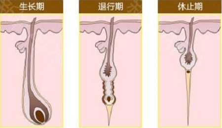 冰點(diǎn)脫腋毛后還會(huì)復(fù)發(fā)嗎