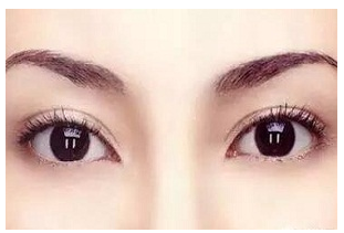 貴陽(yáng)割雙眼皮后留疤是正常現(xiàn)象嗎