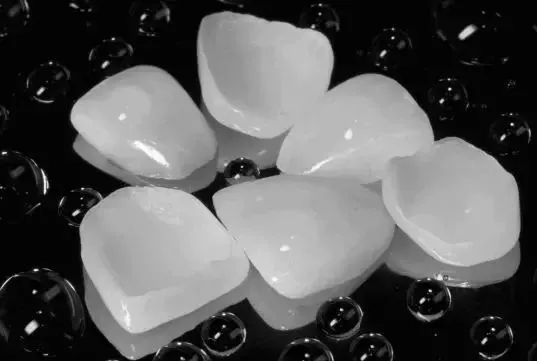 整天所說(shuō)的瓷貼面，究竟是什么？