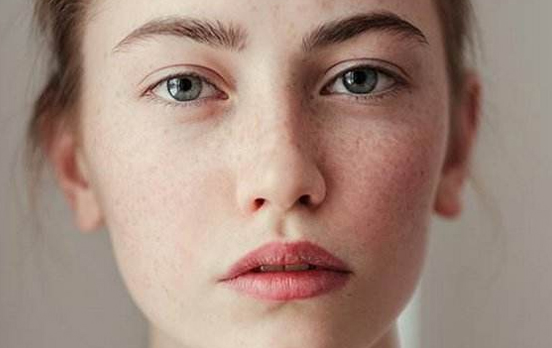 激光祛斑疼嗎？