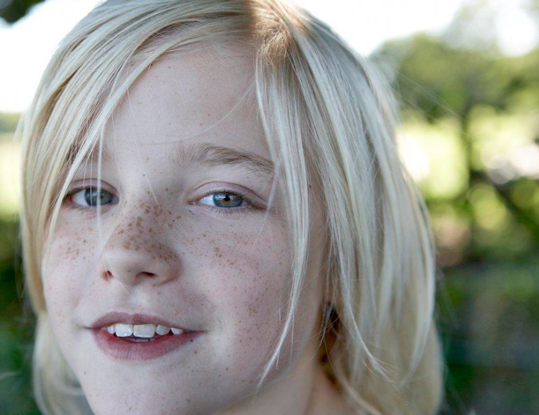 激光祛斑一次多少錢呢？