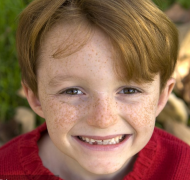 如何去臉上的斑比較有效？