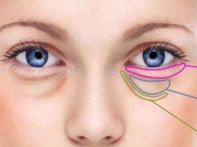 天津祛眼袋手術(shù)需要多少錢呢？