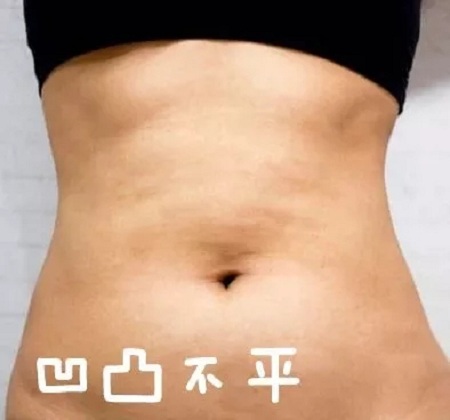 這個(gè)冬天，我“脂”在乎你，就來(lái)美萊吧