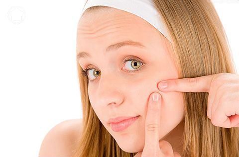 激光怎樣去痘?。坑惺裁葱枰⒁獾?？