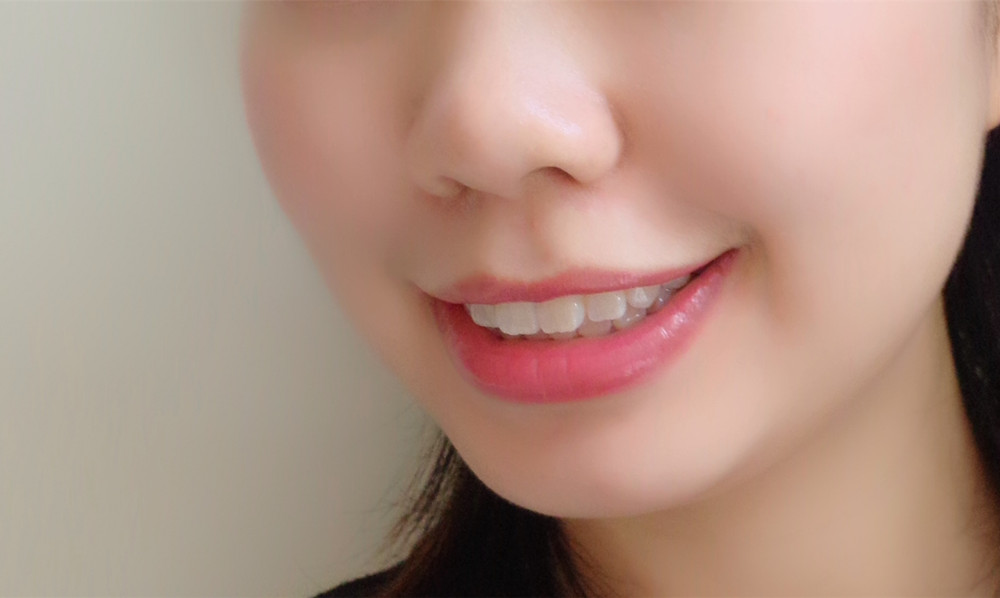 鑲牙多少錢(qián)？