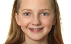 牙齒校正的方法有哪些？