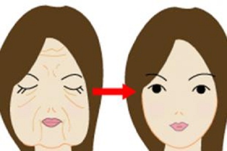 上海做頸部拉皮大概多少錢(qián)