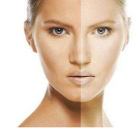 皮膚黃怎么辦？