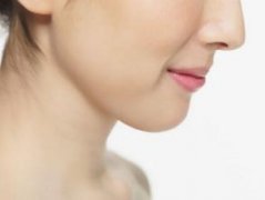 臉部抽脂效果好嗎？