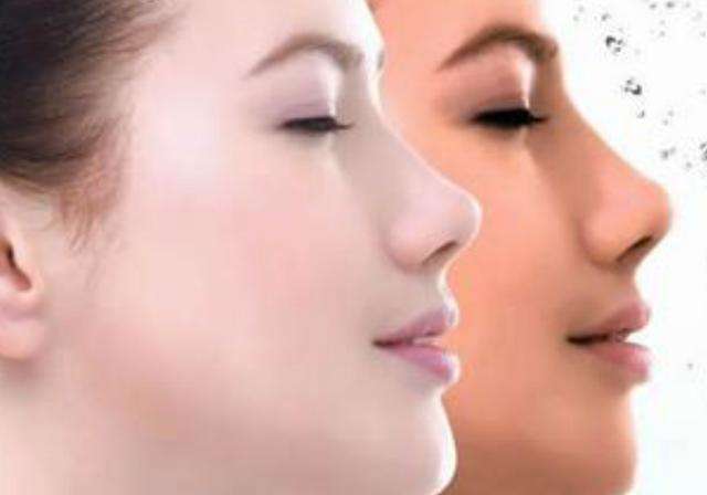 皮膚暗黃怎么改善？