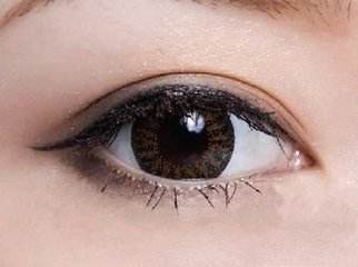 雙眼皮術(shù)后多久能恢復(fù)自然？