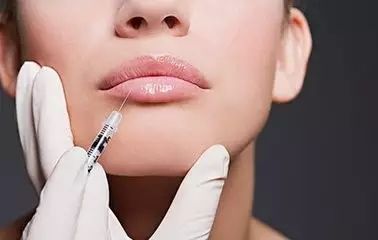 玻尿酸豐唇效果好嗎？
