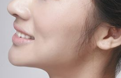 為什么假體墊下巴費用差異那么大？