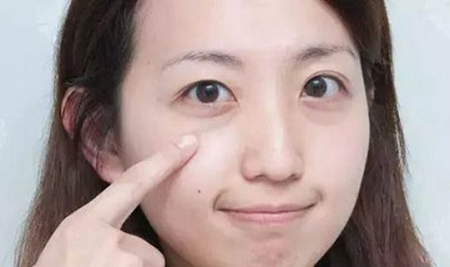 割雙眼皮有哪些類型呢？