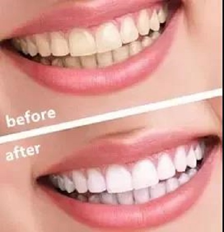 男神嫌棄和我親嘴怎么辦？求助在線等！