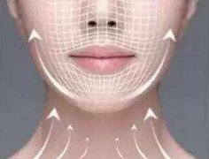 面部埋線提升的效果可維持多久？