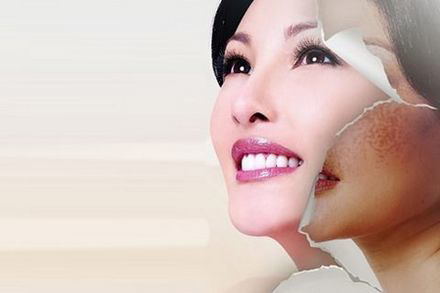 武漢激光祛斑的一般需要多少錢？