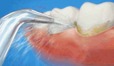 土味大黃牙？趕緊get牙齒美白方法！