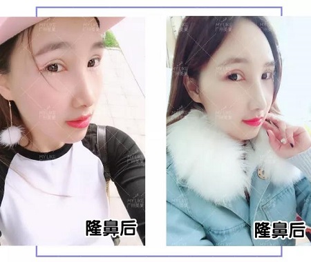 從萬(wàn)人嫌到萬(wàn)人迷