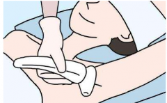 鄭州做冰點(diǎn)脫毛需要注意哪些？