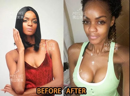 那位鼓起勇氣做了豐胸的模特Taty，現(xiàn)在怎么樣了？