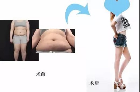 瘦1圈就像瘦30斤，這真的不是開玩笑！