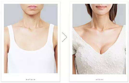 天津整形隆胸手術(shù)多少錢？