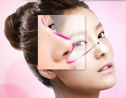 武漢鼻翼縮小術(shù)價格需要多少？