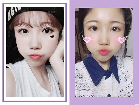 眼睛加寬2mm，還能顯嫩10多歲？！