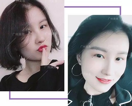 幼齒顏3要素，你的脂肪夠嗎？