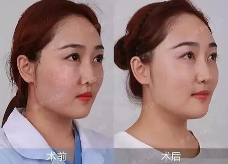 全日本女生較想整容的范本竟是她？！