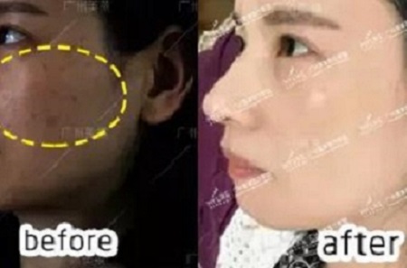 祛斑30天，蛻變?nèi)沼洠?></a>
                                    <a href=