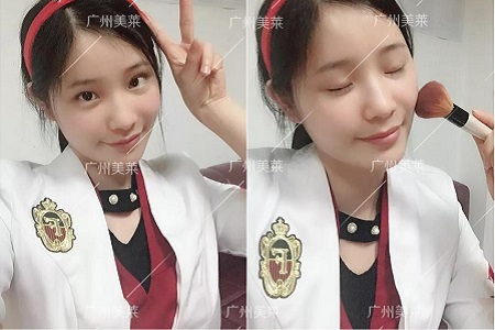 脂肪填充這3個(gè)部位，讓你更美更年輕！